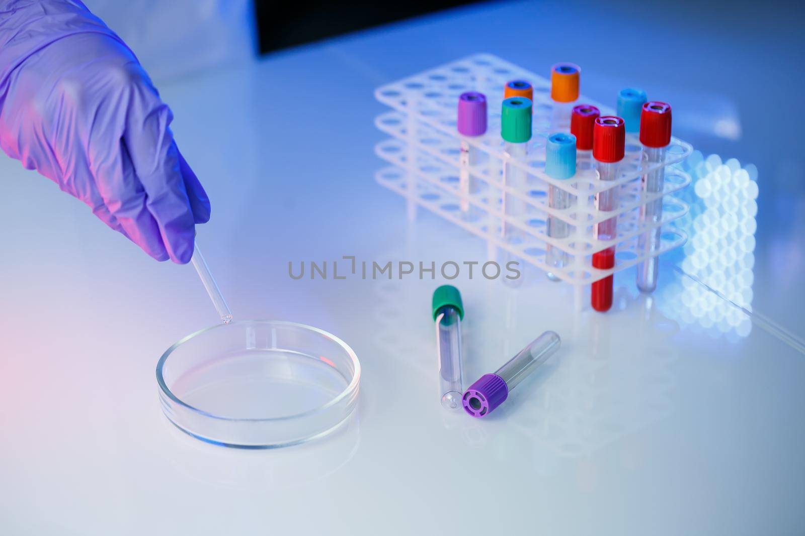 A medical professional, laboratory assistant, doctor performs an analysis in a laboratory, uses test tubes, a pipette and a petri dish for the presence of bacteria in the human body