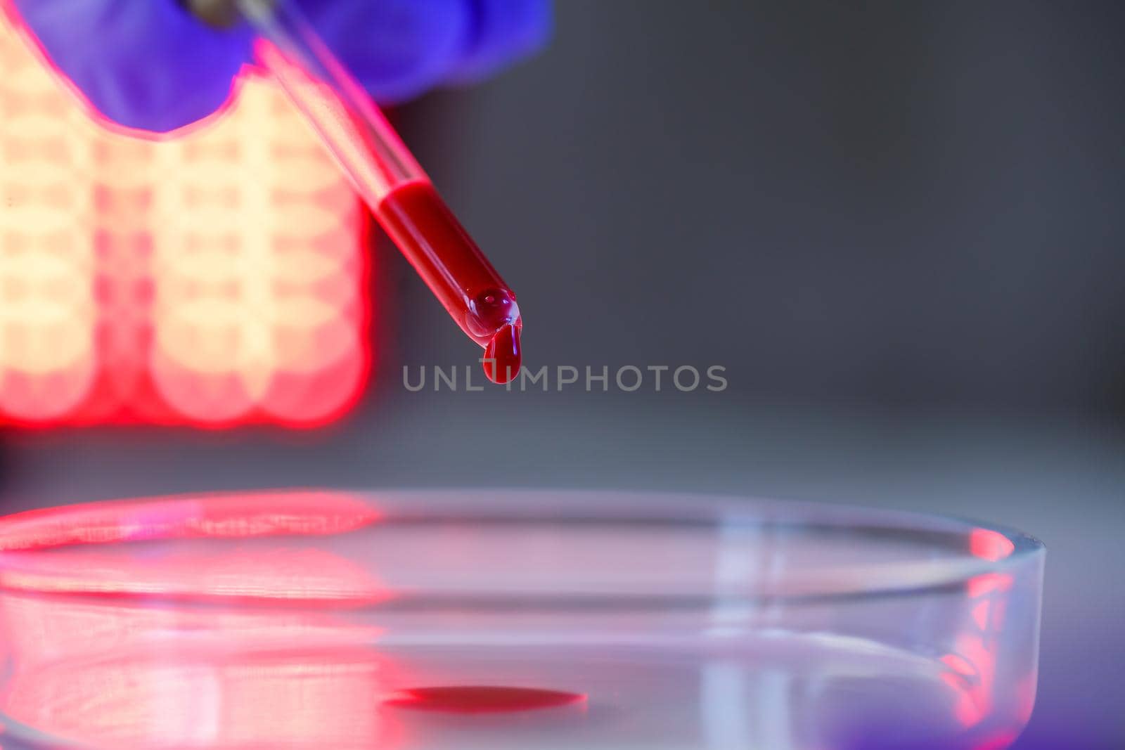 A medical professional, laboratory assistant, doctor performs an analysis in a laboratory, uses test tubes, a pipette and a petri dish for the presence of bacteria in the human body. Selective focus