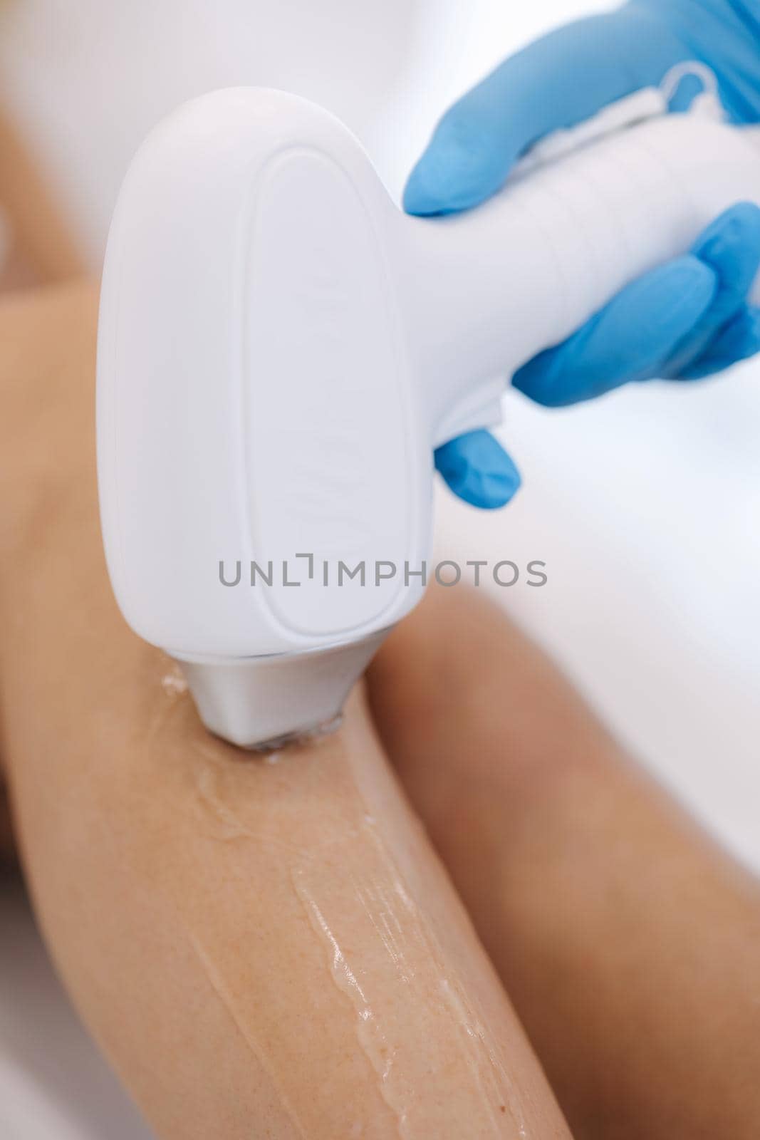 Beautician doing epilation on beautiful woman's leg in mediacl center. Female receiving laser light hair removal treatment for hairless smooth skin at cosmetology salon.