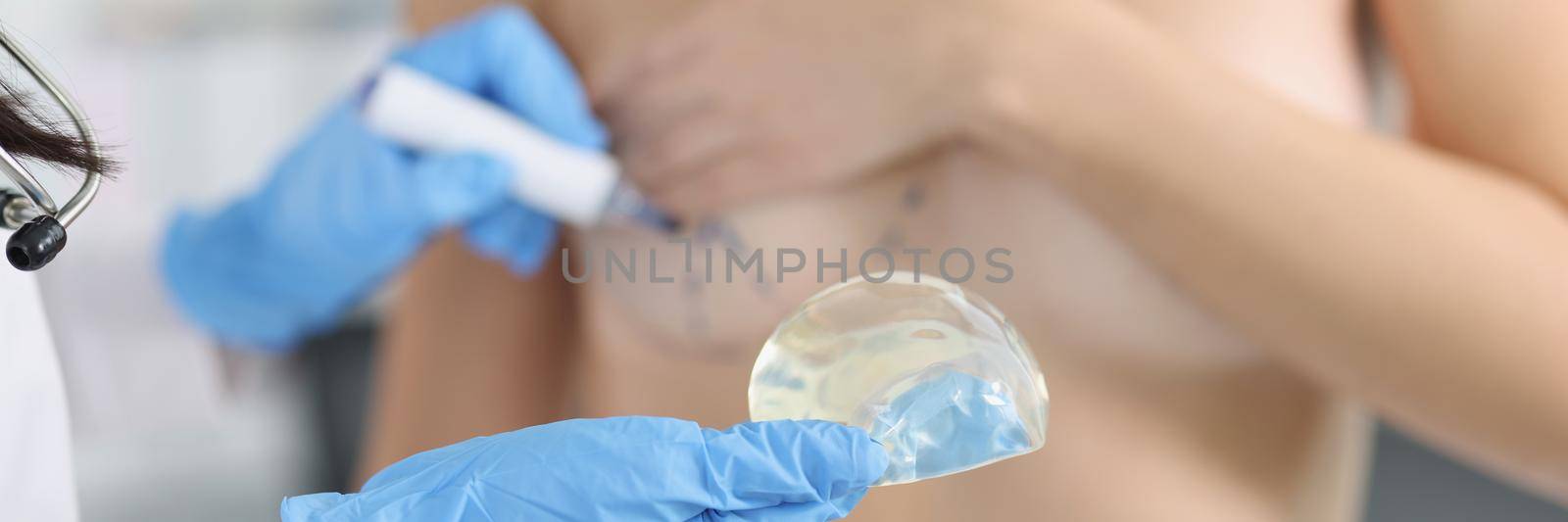 Close-up of doctor hold silicone implant and marking client breast. Woman topless in doctor cabinet. Surgery, beauty, medicine, plastic operation concept