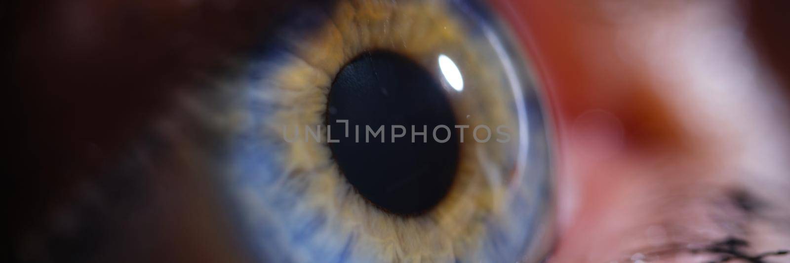 Woman with bright blue eyes on iris. Laser vision correction concept