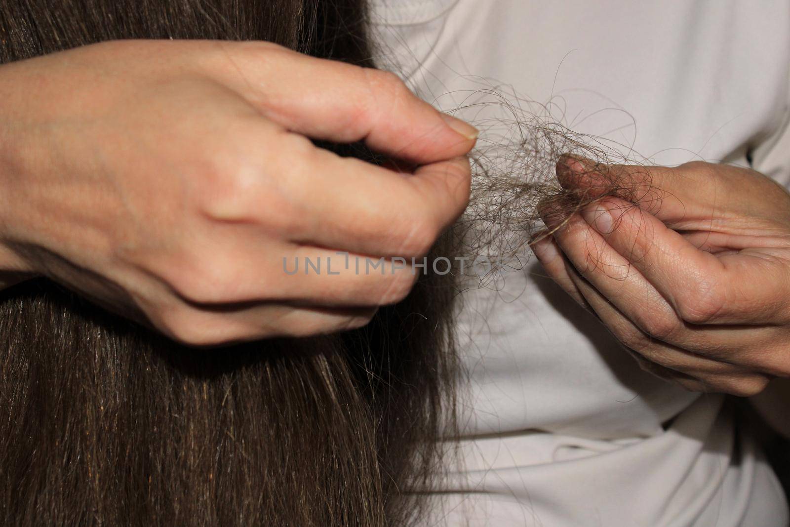 A girl with long dark hair holds a bunch of fallen hair in her hands. Hair loss problem.. by IronG96