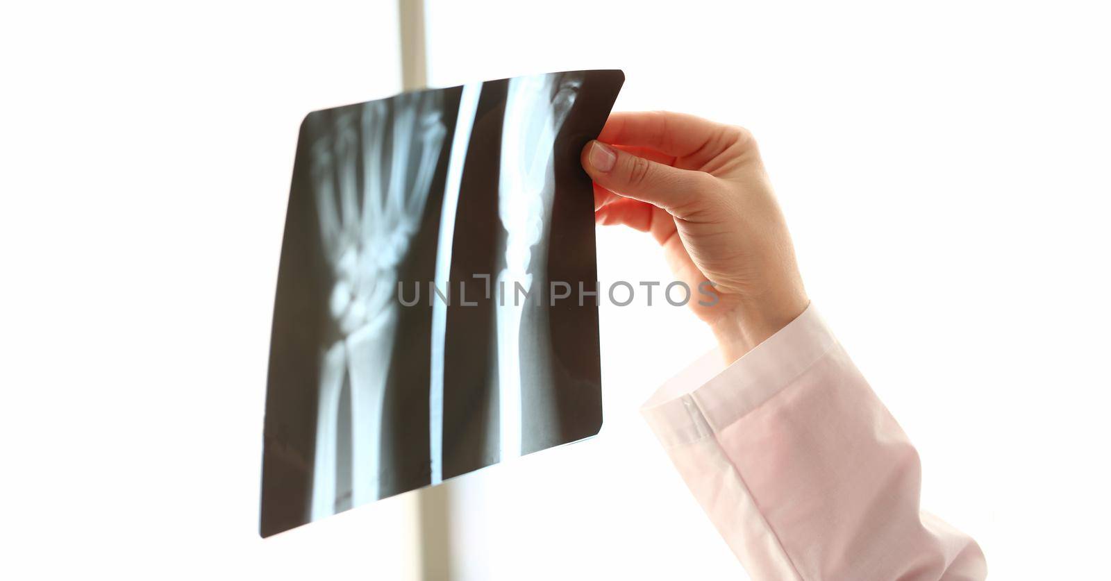 Orthopedic doctor examines image of hands on x-ray. Pain in joints of arm concept