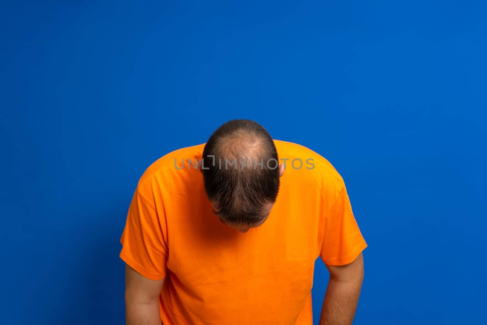 Man in an orange t-shirt leaning his head forward to reveal his bald spot, isolated on blue studio background