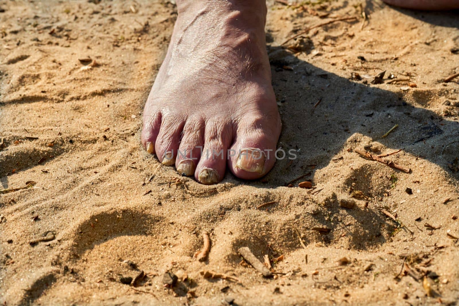 the lower extremity of the leg below the ankle, on which a person stands or walks. Foot of an elderly man with painful brittle nails on the summer sand. High quality photo