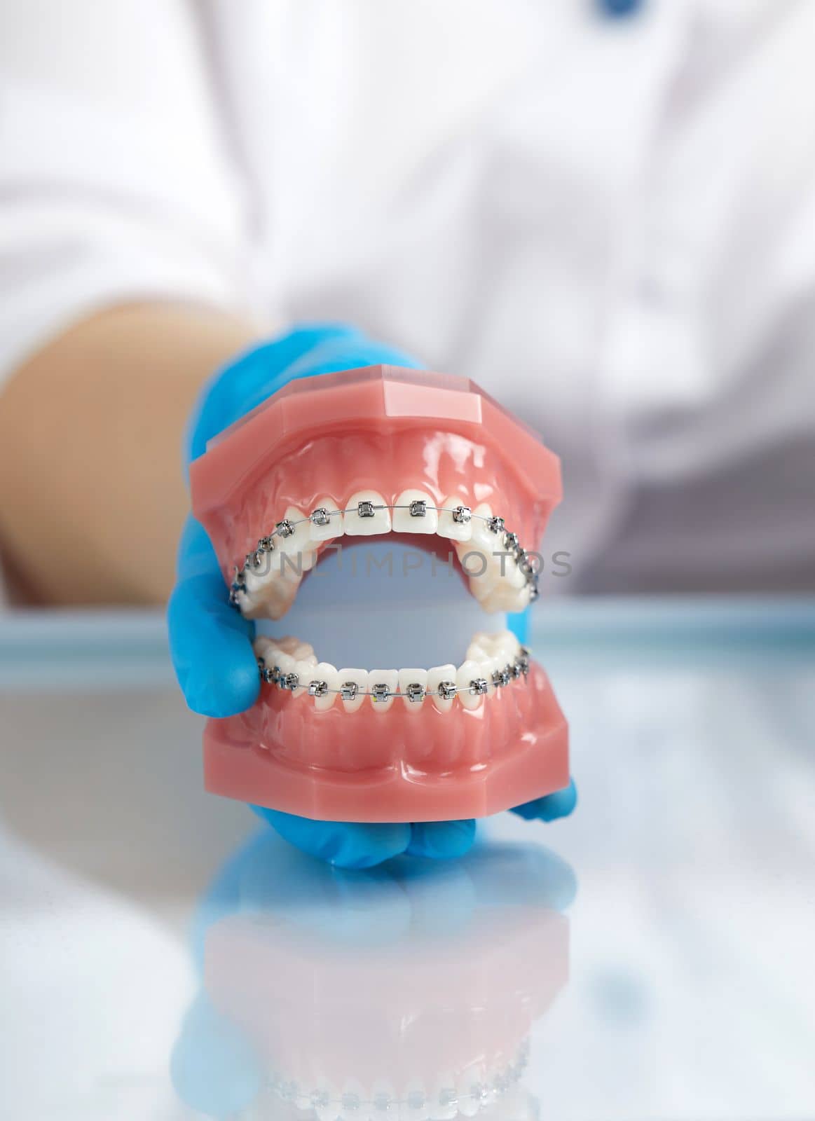 Orthodontist shows how the system of braces on teeth is arranged on an artificial jaws