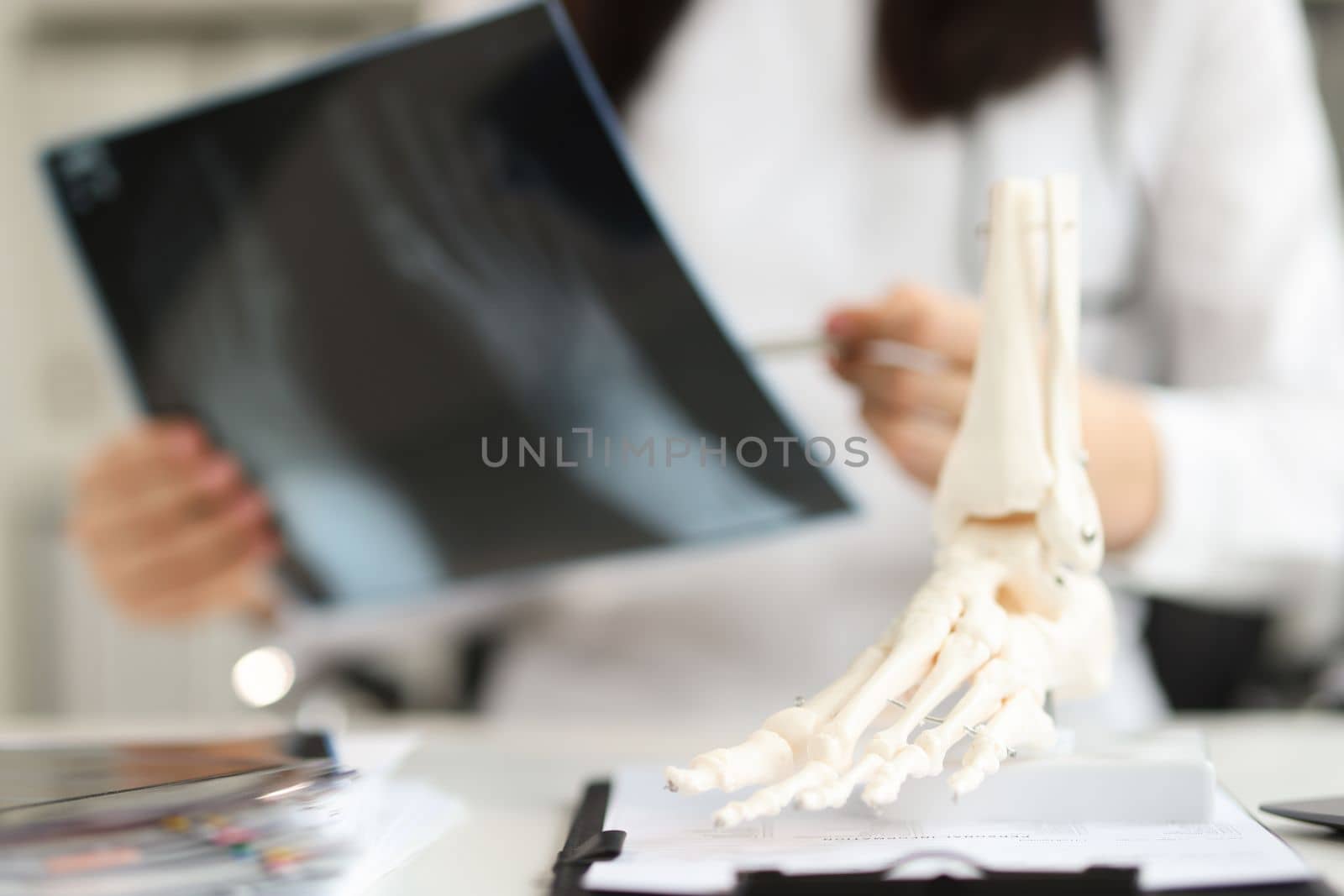 Doctor holds x-ray of foot and anatomy of bones of leg. Diagnosis and treatment of arthritis concept