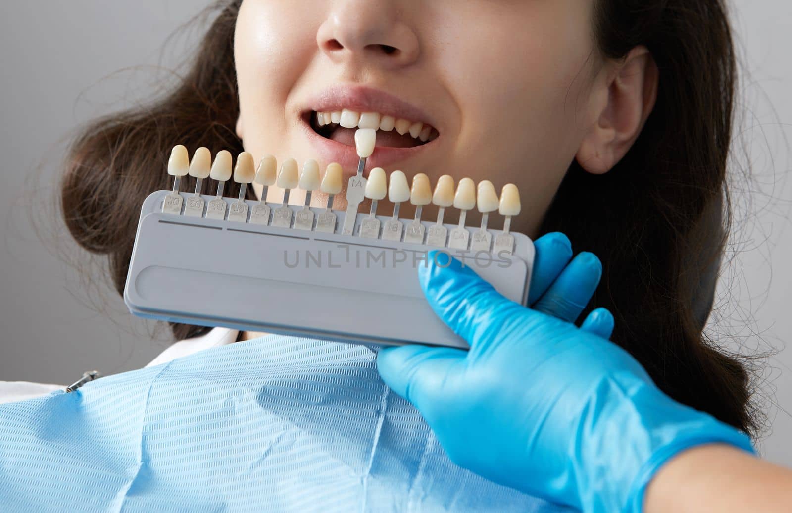 Dentist choosing color of tooth enamel for patient. Dentist applying sample from tooth enamel scale to caucasian female teeth by Mariakray