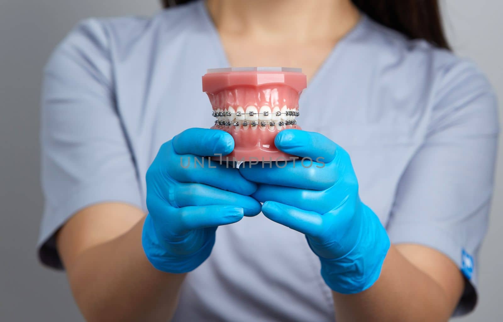 Orthodontist shows how the system of braces on teeth is arranged on an artificial jaws