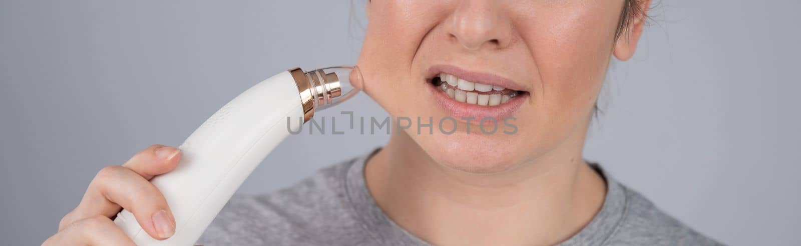 Caucasian woman uses a vacuum pore cleaner at home. by mrwed54