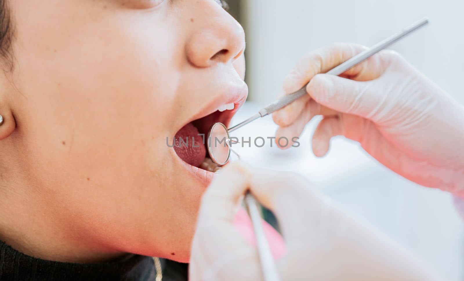 Close up of patient checked by dentist, Dentist checking patient's mouth, close up of dentist's hands checking patient's mouth, Dentist performing stomatology by isaiphoto