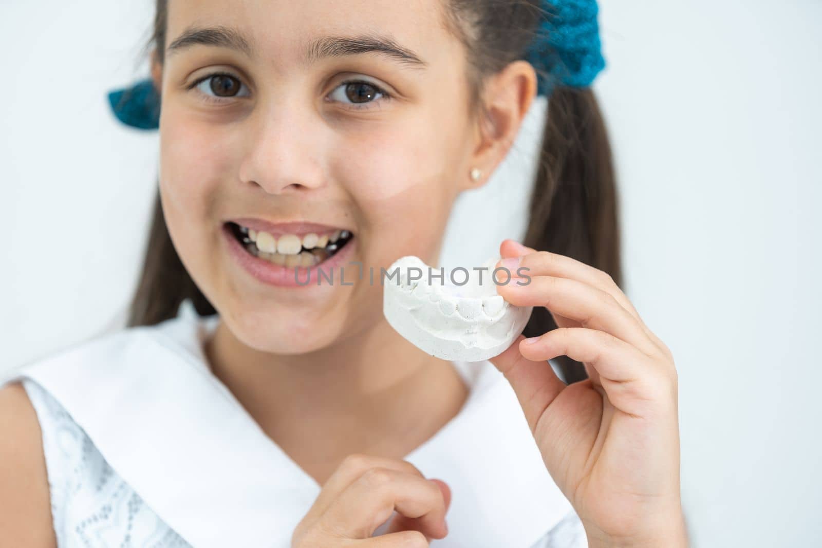 little girl with plaster cast of teeth and with the metal apparatus on the teeth