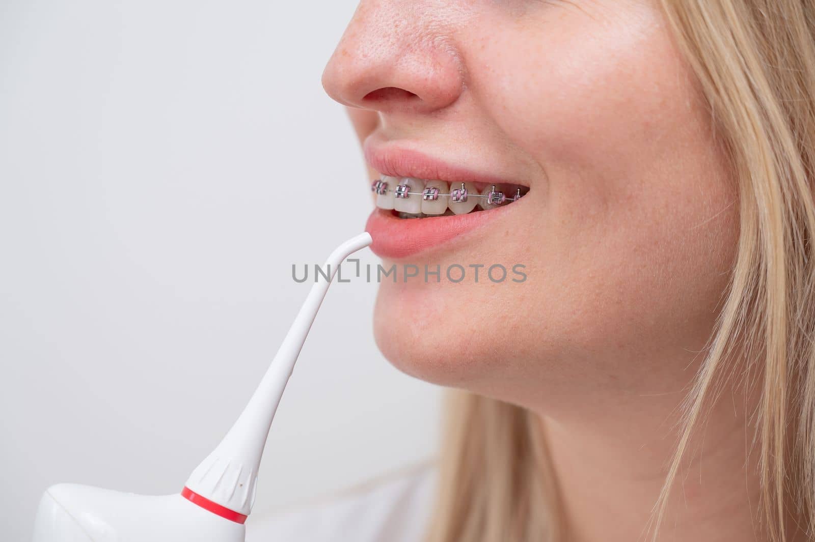 Portrait of a caucasian woman with braces on her teeth holding an irrigator