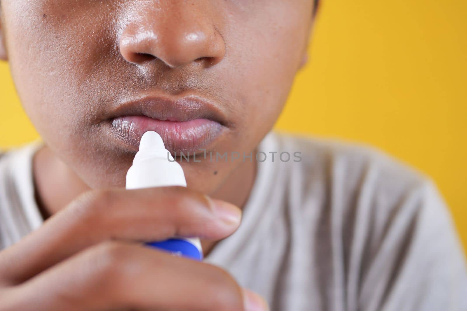  young man applying moisturising lip balm on lips.
