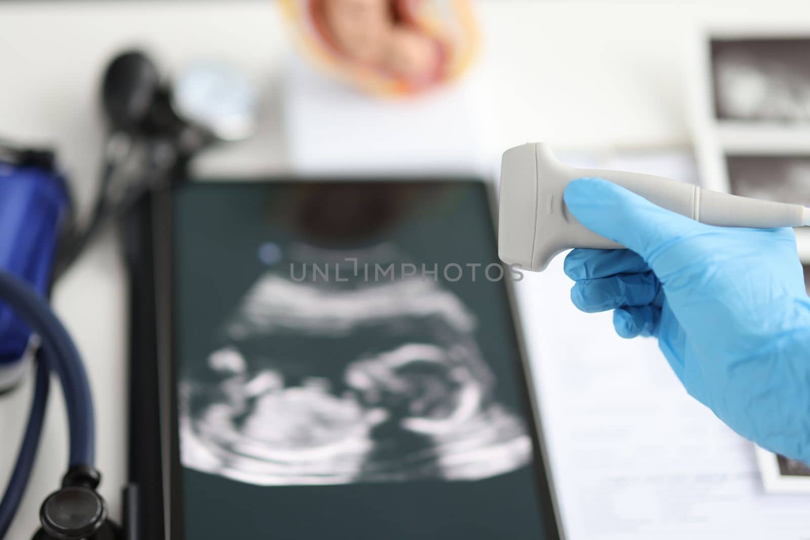 Ultrasound picture and doctor transcranial dopplerography of child in womb. Examination of fetus of child concept