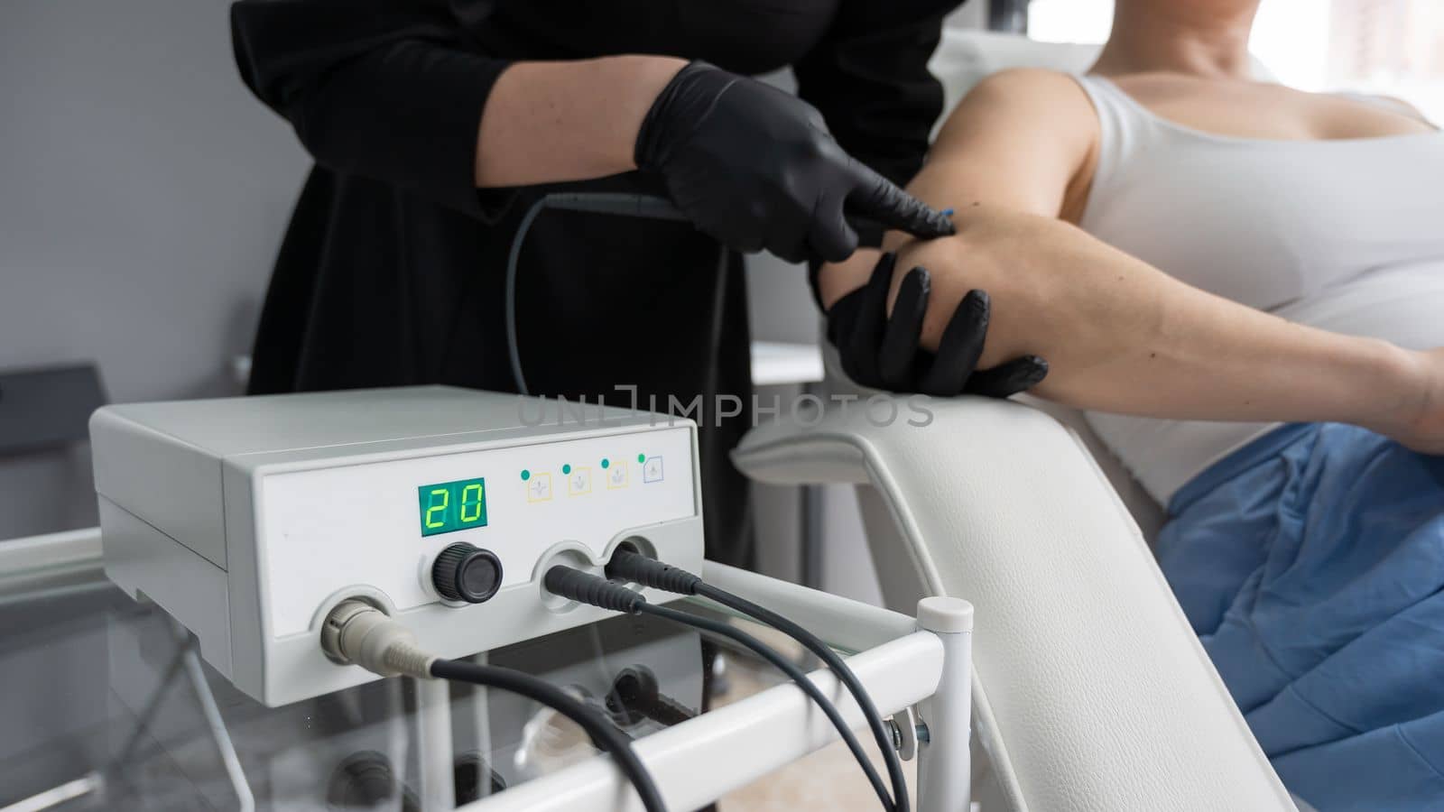 Dermatologist removes a mole on a patient's arm using an electrocoagulator