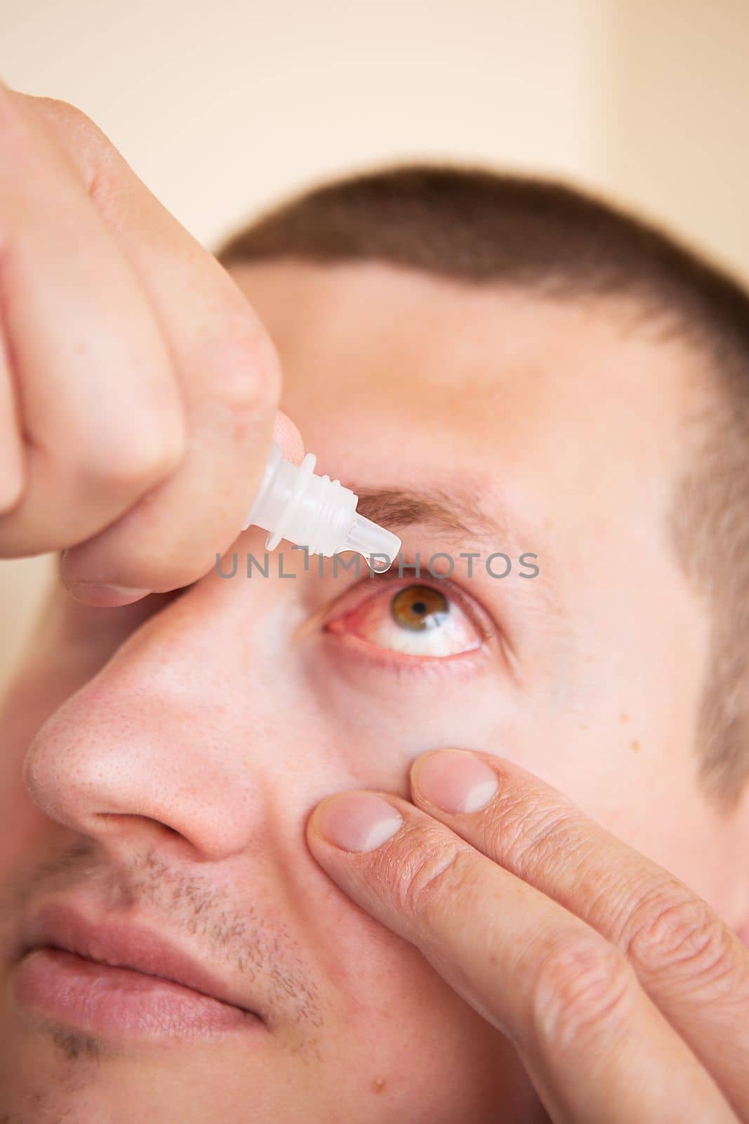 Take care of his eyes. Portrait of a young man dripping drops into his eyes. Close-up