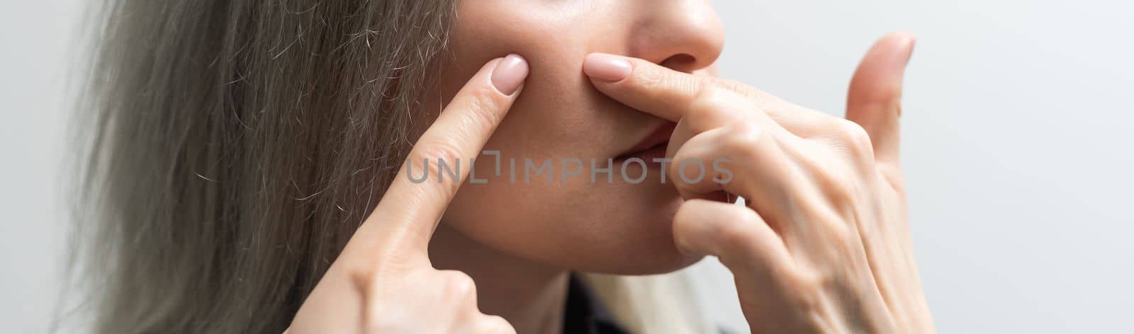 young woman squeezing pimples on the face.