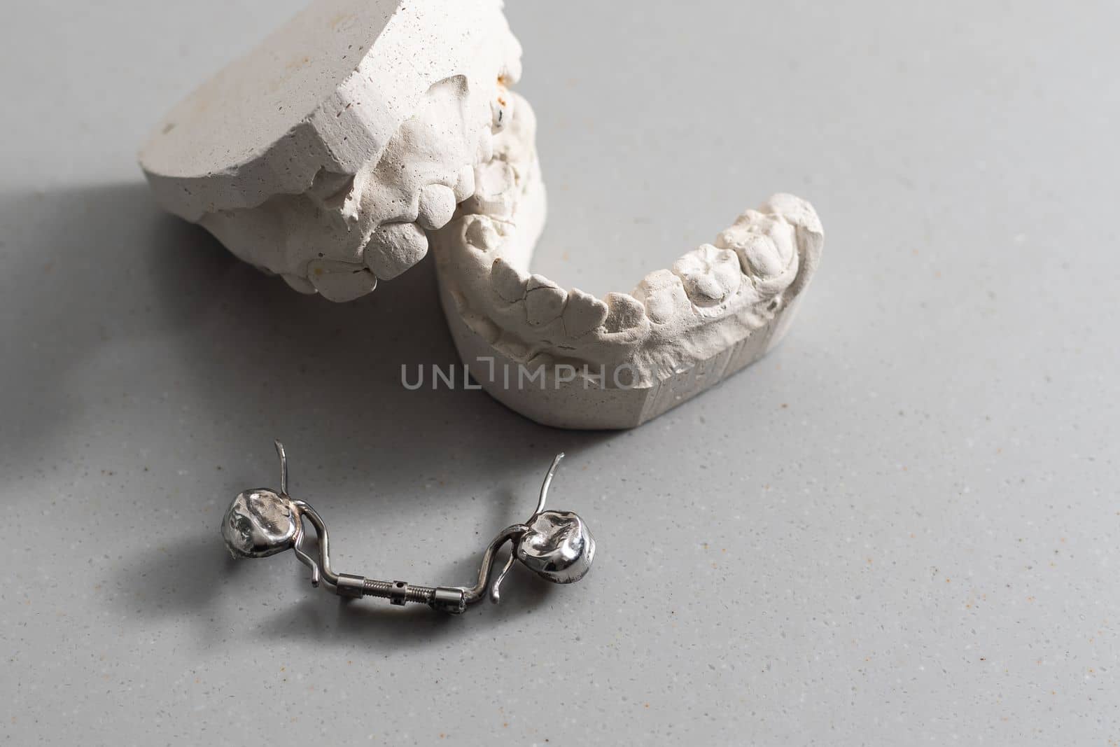 Plaster models of dental prostheses. Demonstration models of dentures. Visual demonstration of orthodontic prostheses. False teeth. Prosthetic dentistry. Dental plates top view. Artificial tooth by Andelov13