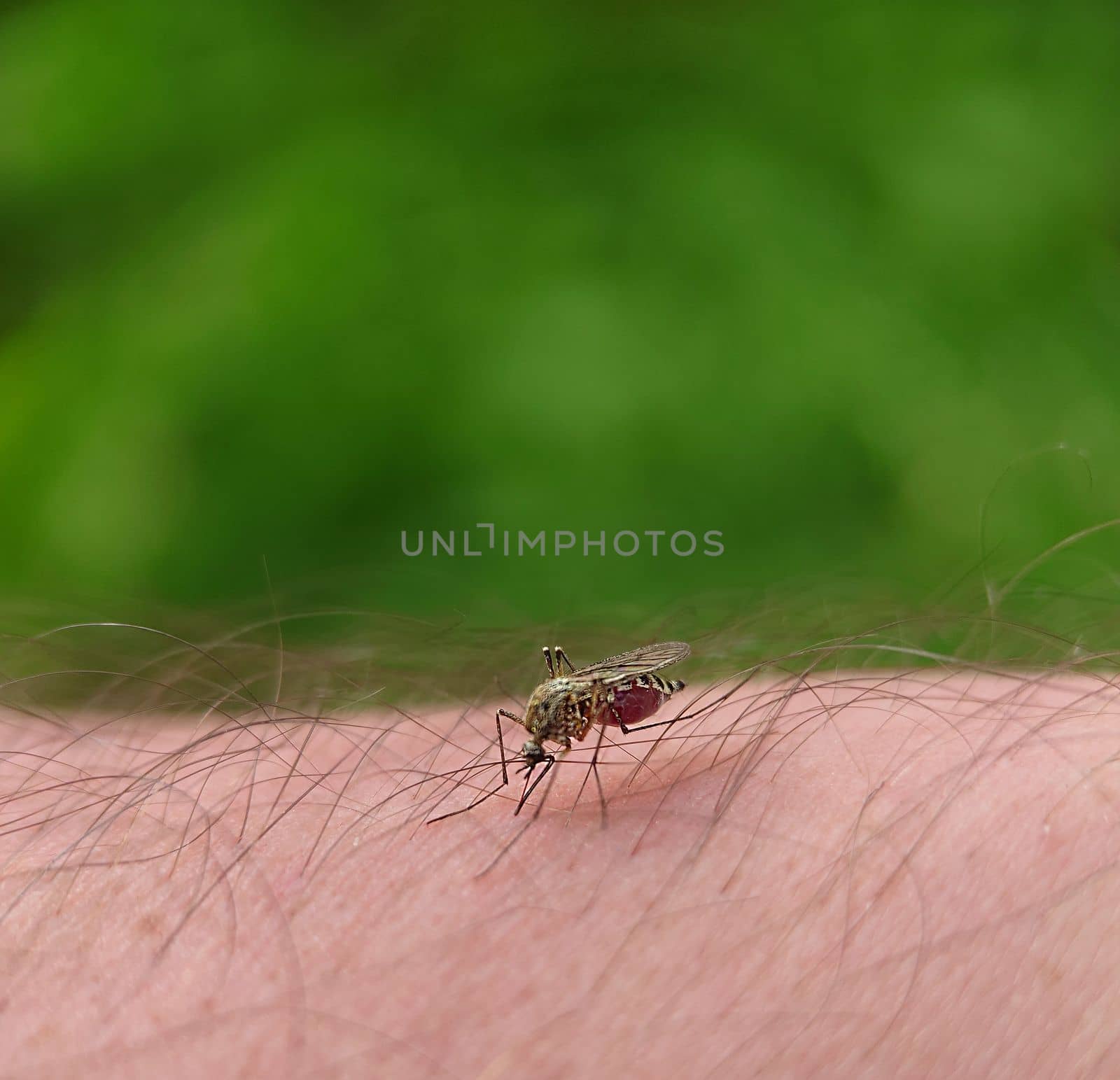 A mosquito drinks blood from a man's hairy leg in close-up.Macrophotography.Selective focus.