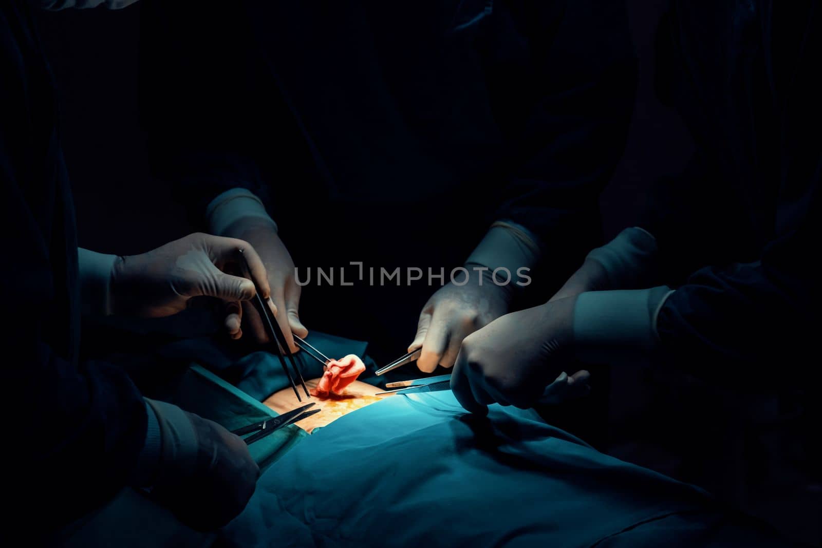 Surgical team performing surgery to patient in sterile operating room. In a surgery room lit by a lamp, a professional and confident surgical team provides medical care to an unconscious patient.