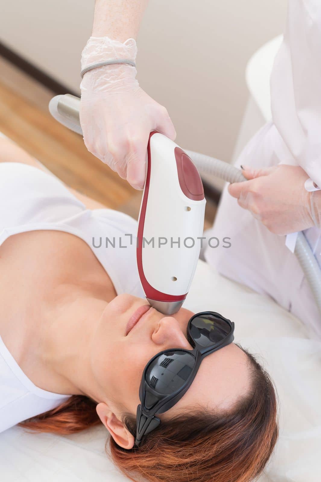 Close-up of laser hair removal on a woman's face. The doctor removes unwanted hair from the patient above the lip with an electric device.