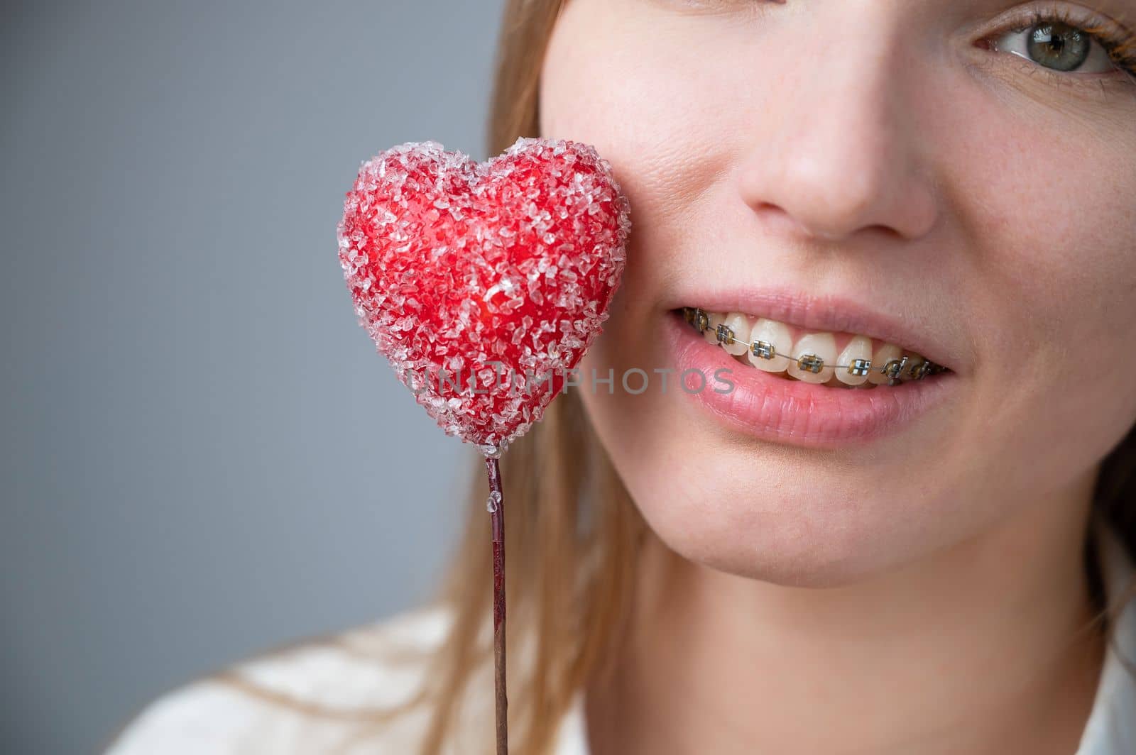 Cute woman with braces on her teeth holds a candy in the form of a heart on white background.