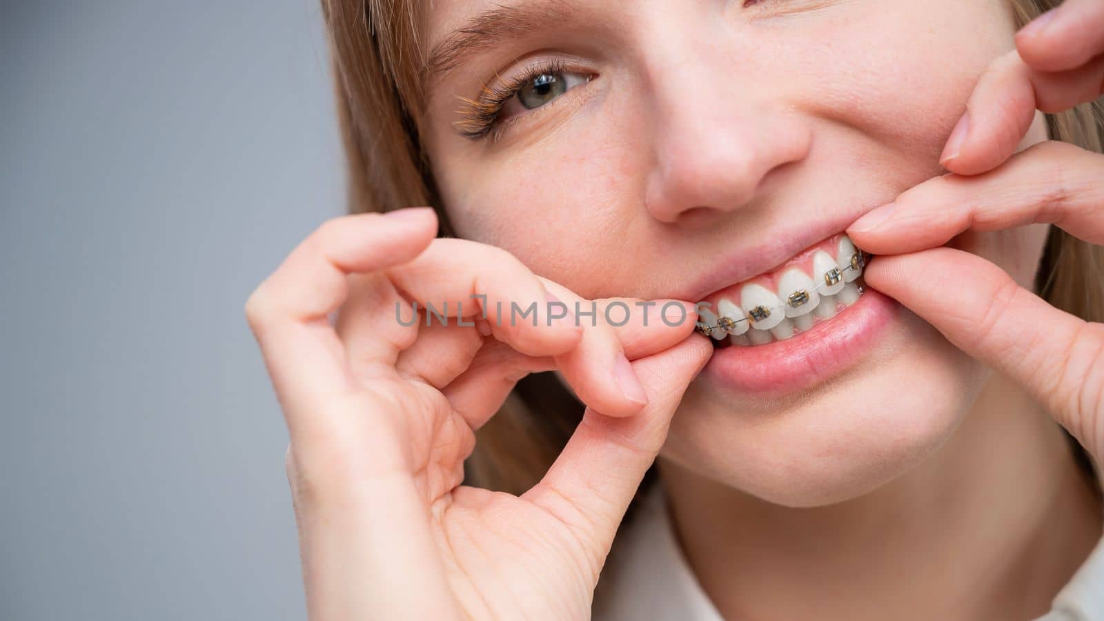 Close-up portrait of a red-haired girl touching braces. Young woman corrects bite with orthodontic appliance. by mrwed54