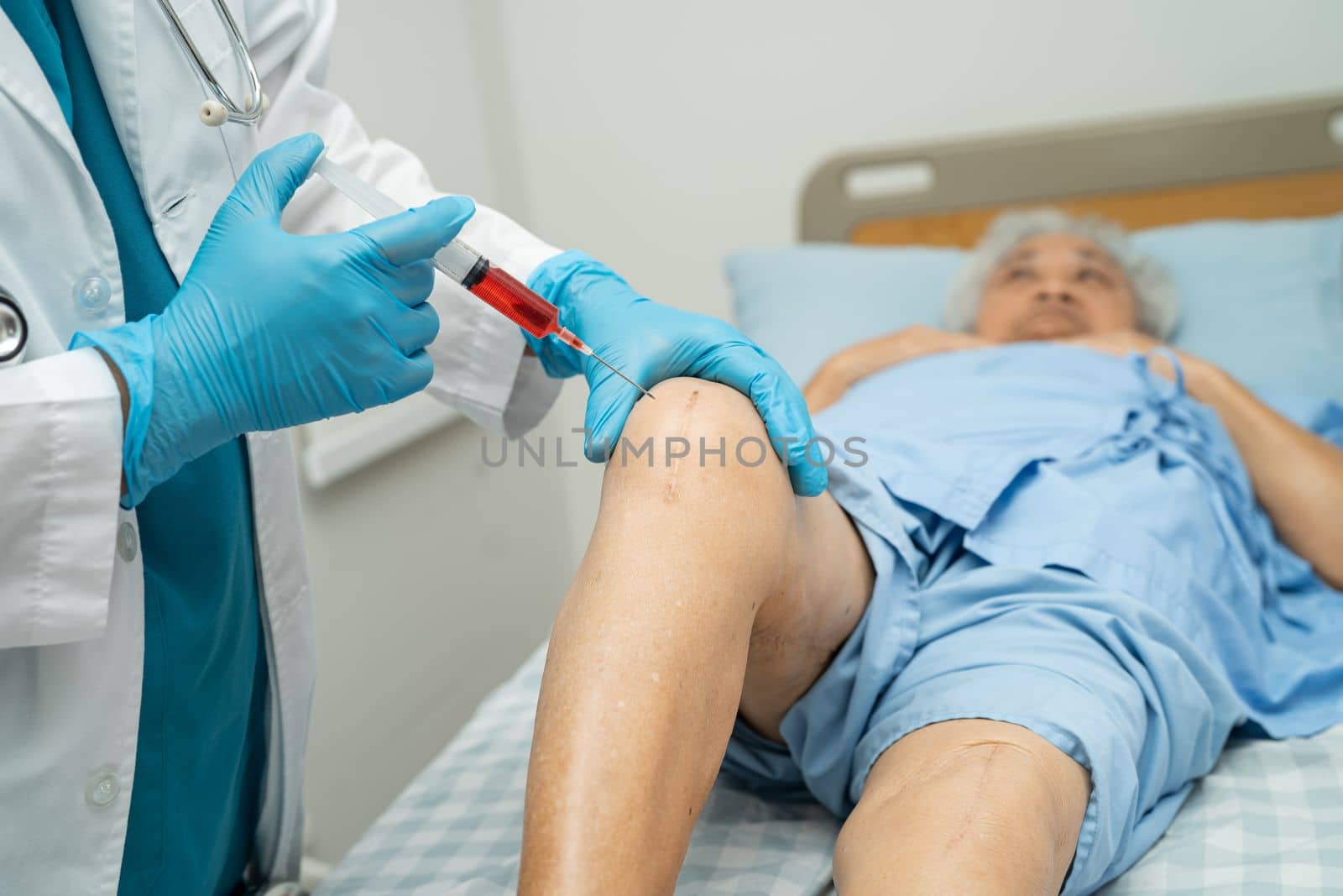 Asian doctor inject Hyaluronic acid platelet rich plasma into the knee of senior woman to walk without pain.