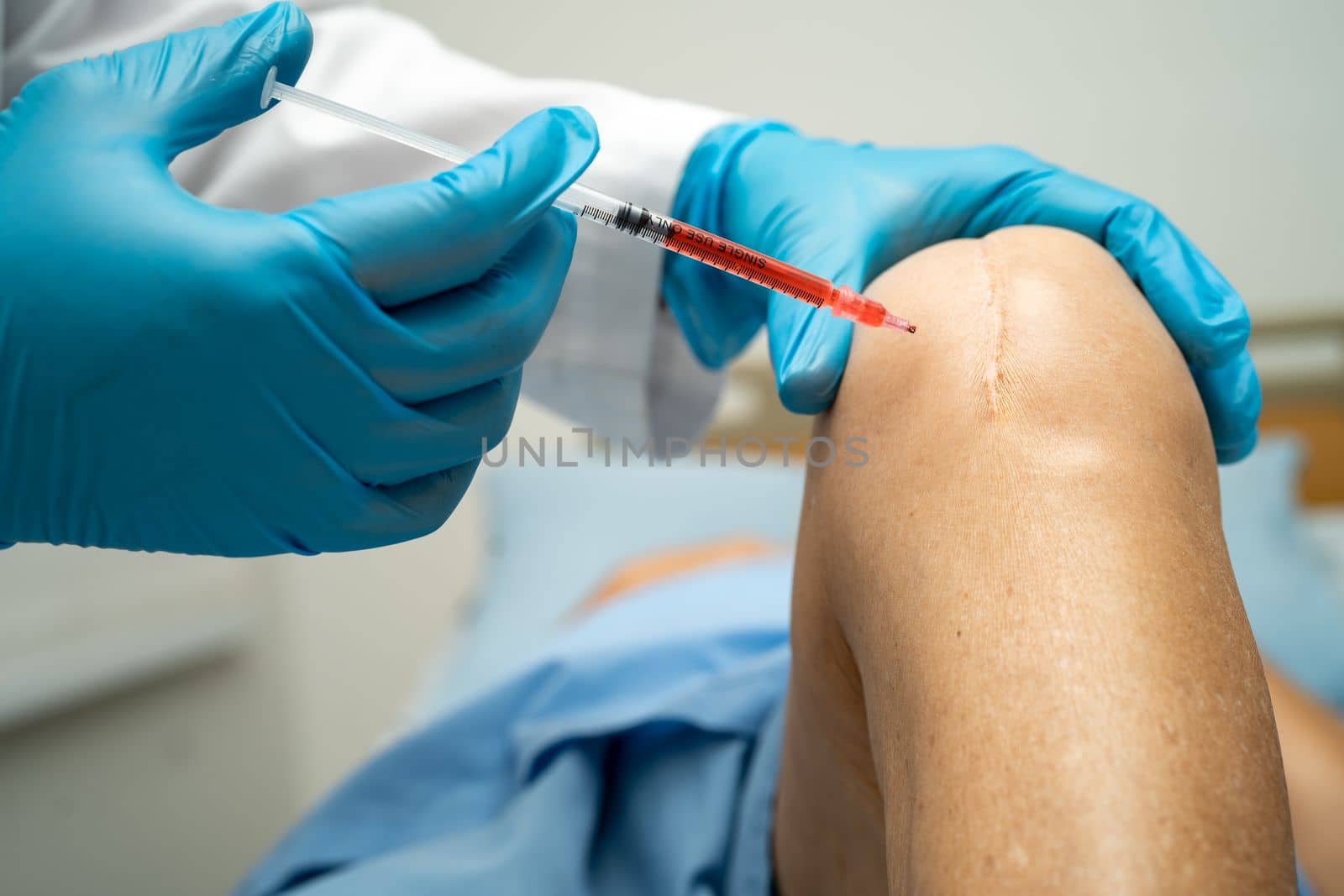 Asian doctor inject Hyaluronic acid platelet rich plasma into the knee of senior woman to walk without pain. by pamai