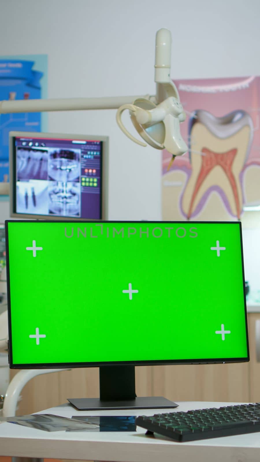 Computer with green screen placed in front of camera in empty modern equipped stomatological room. Stomatology clinic with nobody in it prepared for next patient with mock-up, chroma key pc display