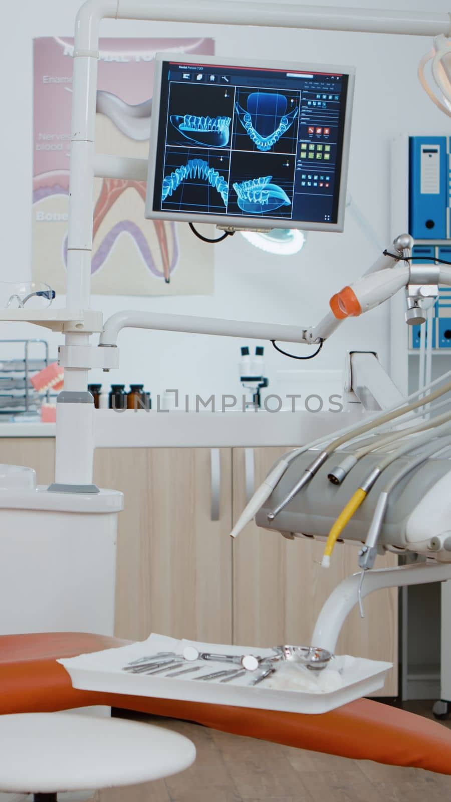 Interior of modern equipped dental office with x ray on monitors, dentist stomatology orthodontic workplace. Zoom in shoot. Medical cabinet for teethcare, treatment clinic