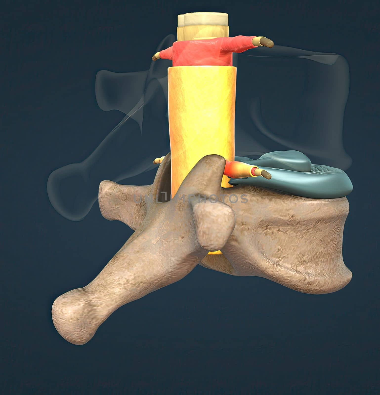 A slipped disc may also be called a prolapsed or herniated disc. 3d illustration