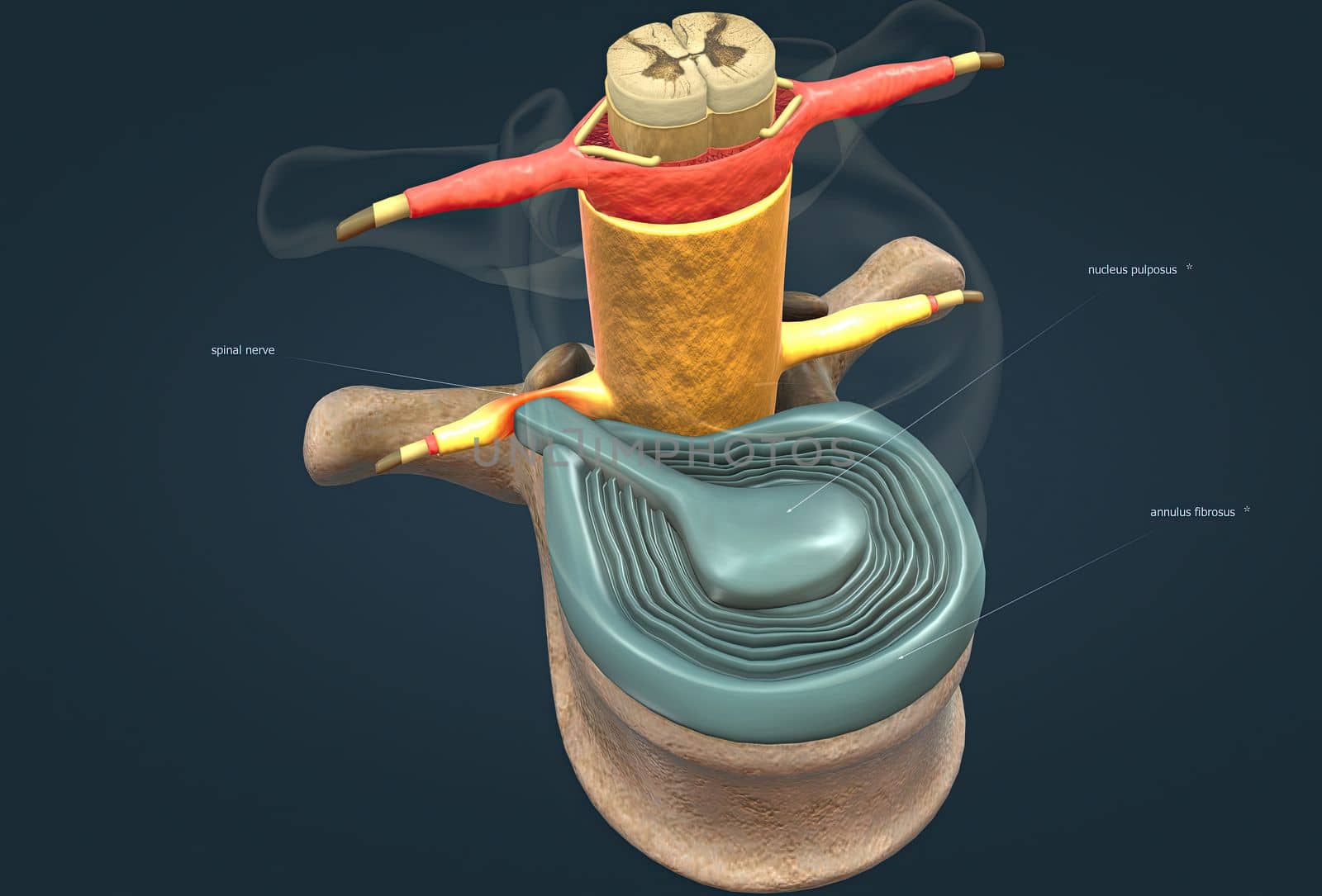 A slipped disc may also be called a prolapsed or herniated disc. 3d illustration