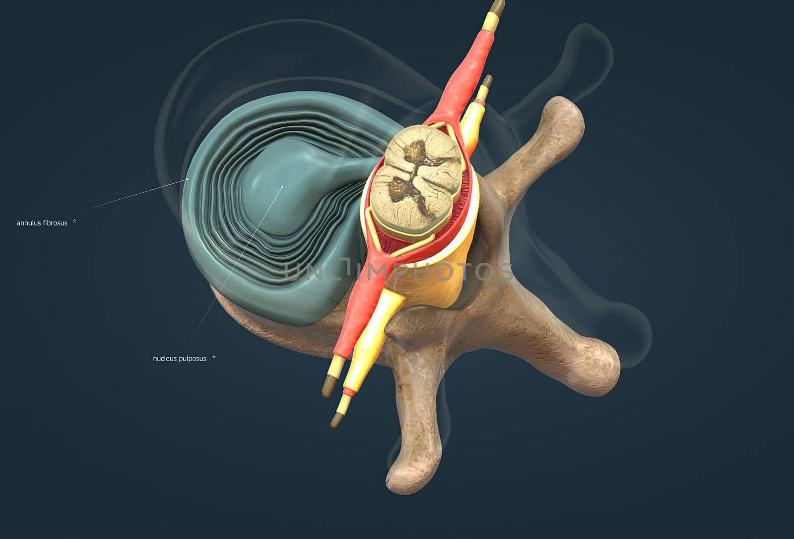 A slipped disc may also be called a prolapsed or herniated disc. 3d illustration