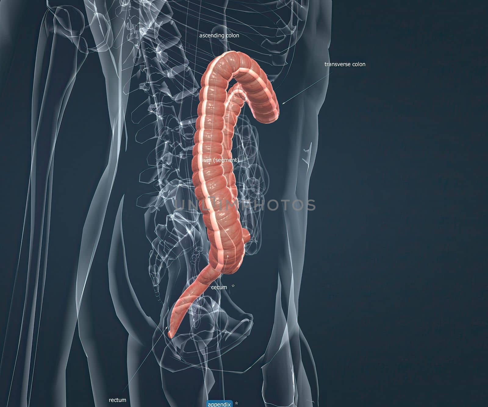 Appendicitis is inflammation of the appendix, a finger-shaped sac protruding from your colon on the lower right side of your abdomen. Appendicitis causes pain in the lower right abdomen. 3d illustration