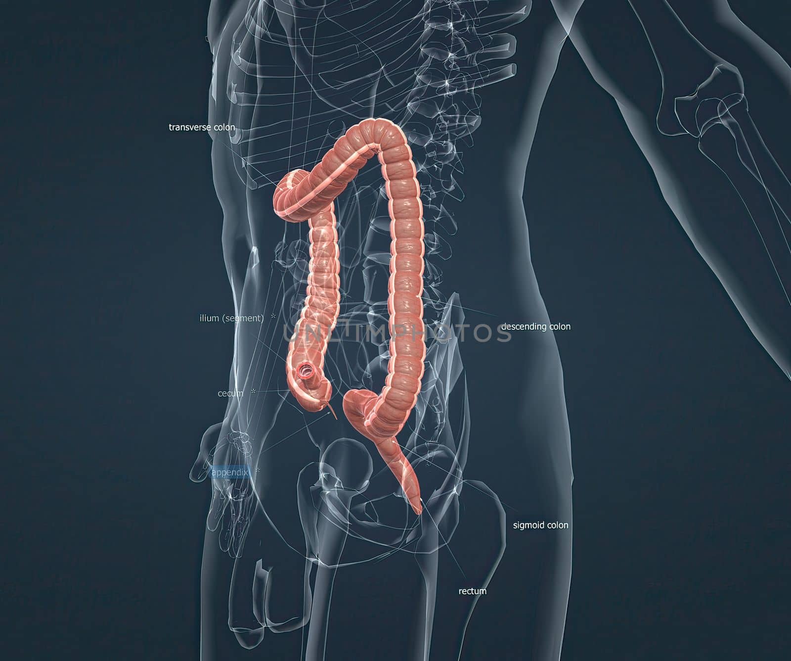 Appendicitis is inflammation of the appendix, a finger-shaped sac protruding from your colon on the lower right side of your abdomen. Appendicitis causes pain in the lower right abdomen. 3d illustration