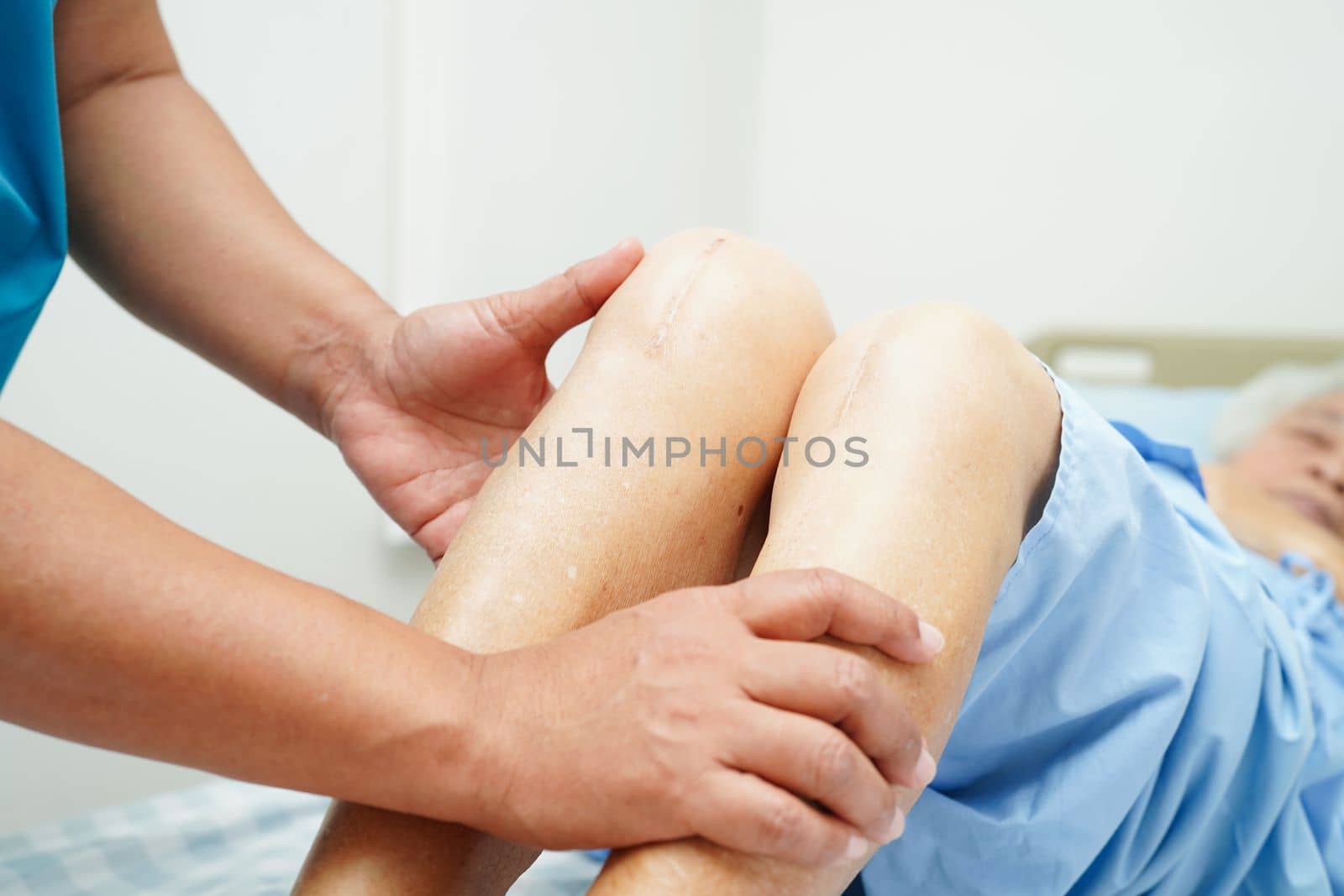 Doctor checking Asian elderly woman patient with scar knee replacement surgery in hospital.