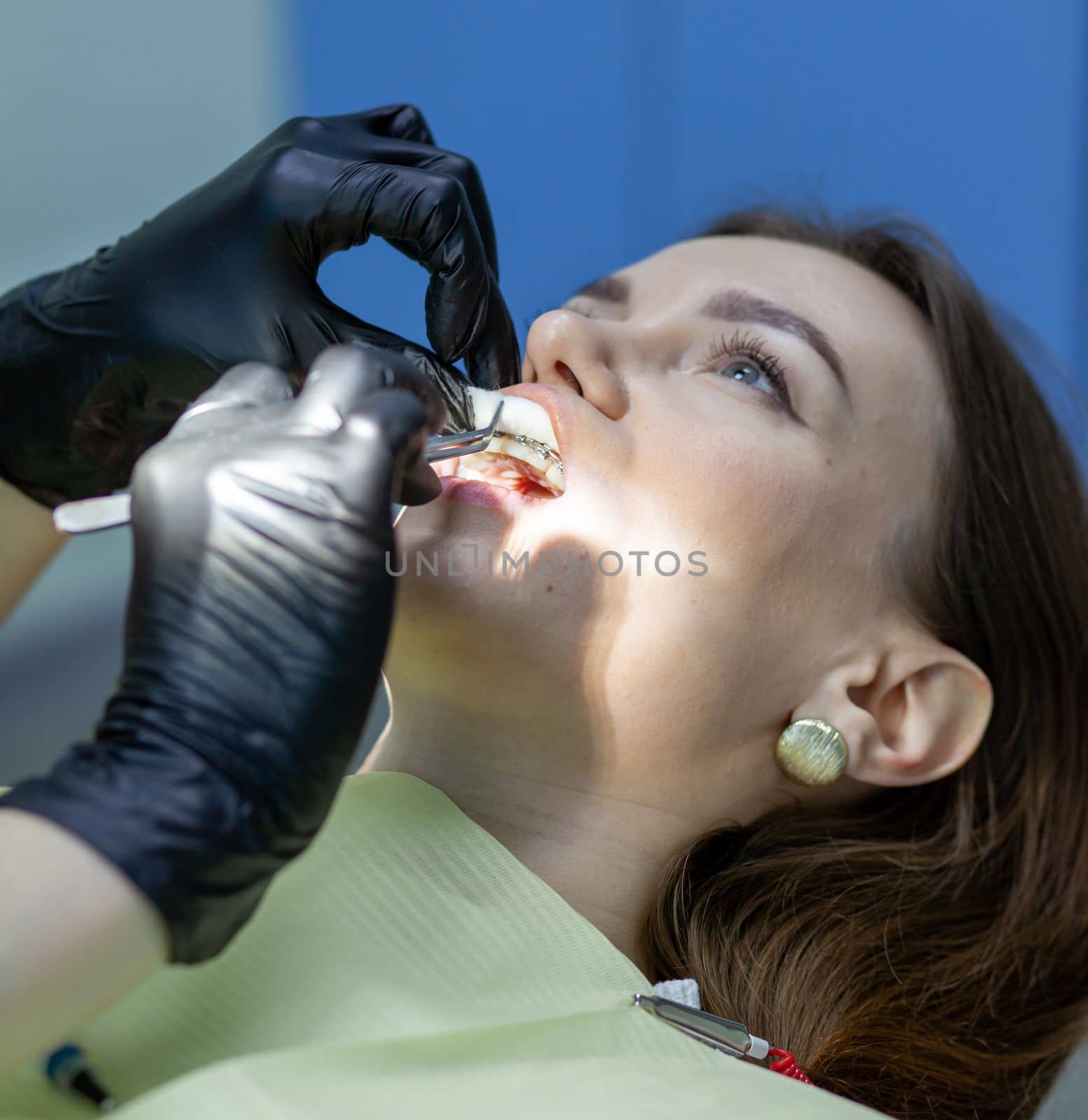 The process of removing braces.Beautiful woman in dental chair during procedure of installing braces to upper and lower teeth. Dentist and assistant working together, dental tools in their hands.