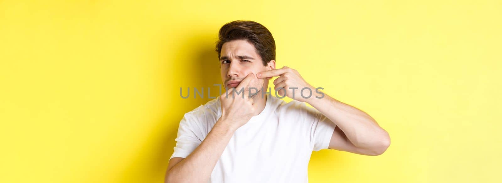 Young man pop a pimple on cheek, standing over yellow background. Concept of skin care and acne.
