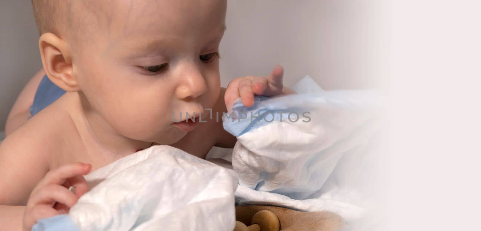 a baby with a hemangioma on his neck lies on a white background. banner with a copy space. profile of a little bald baby girl. the kid looks to the side