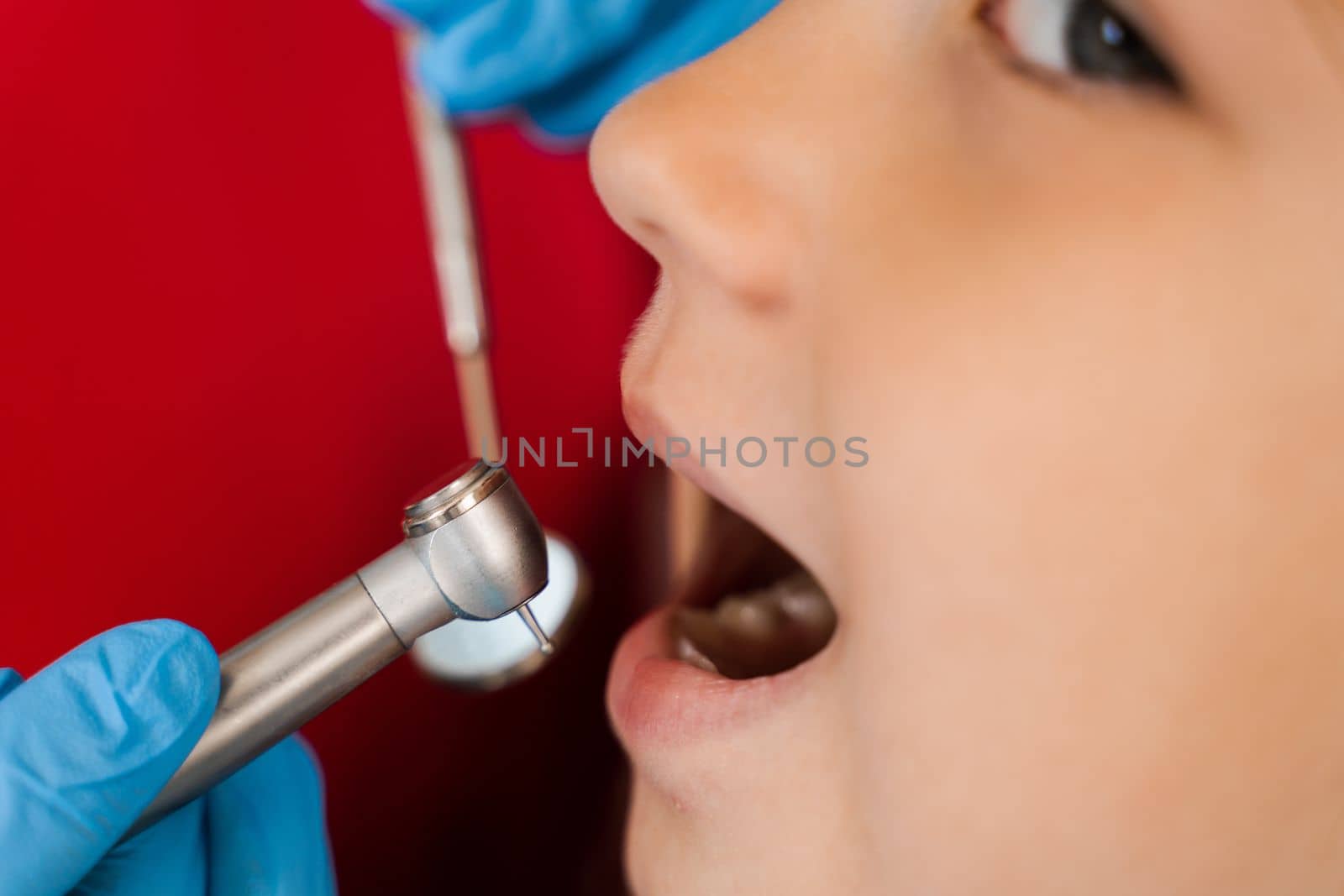 Dental drill close-up. Child dentist drilling teeth of kid girl in dentistry clinic. Teeth treatment. Dental filling for child patient