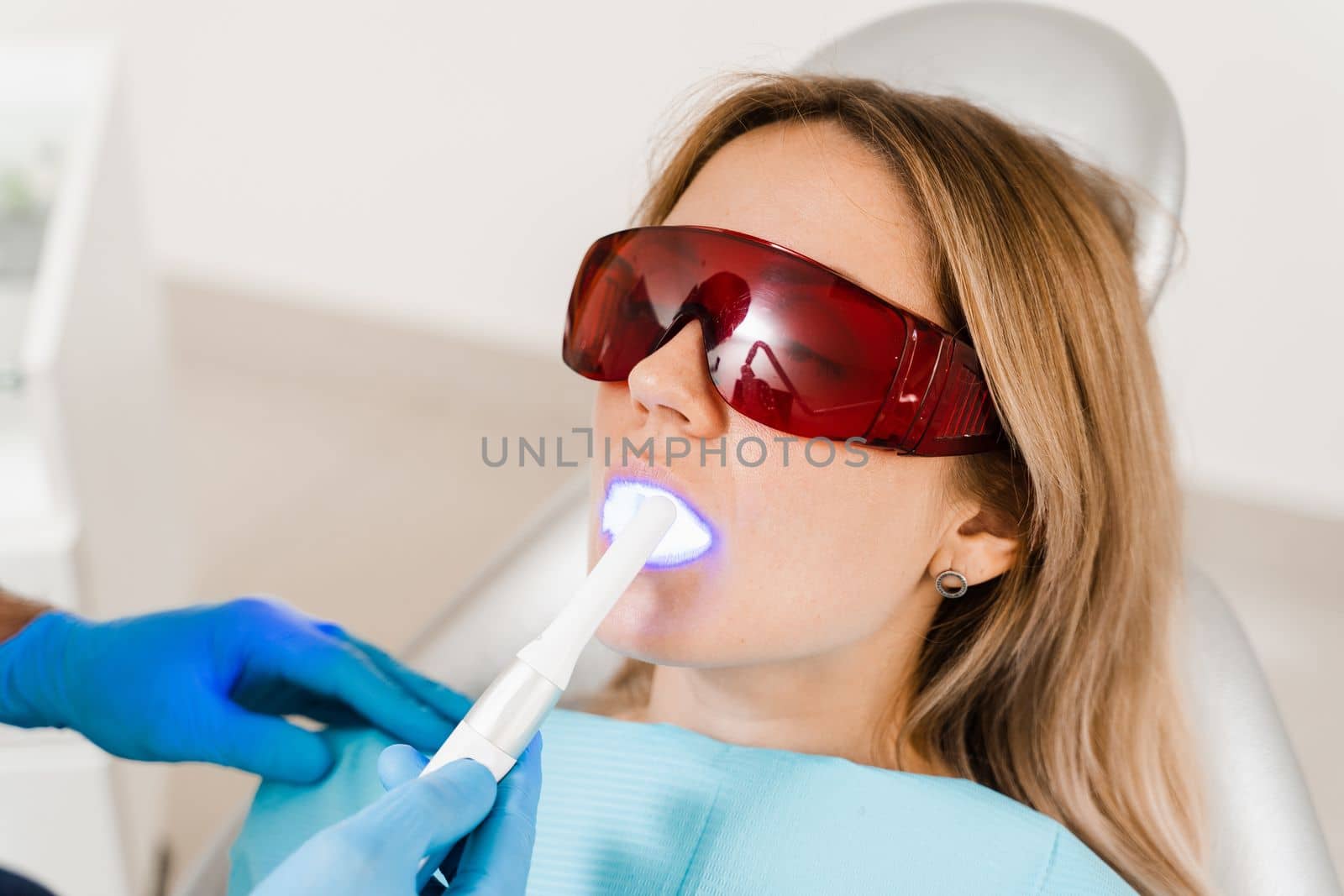 Dentist treats and removes caries in woman patient. Uv illumination of photopolymer tooth filling procedure at dentistry. by Rabizo