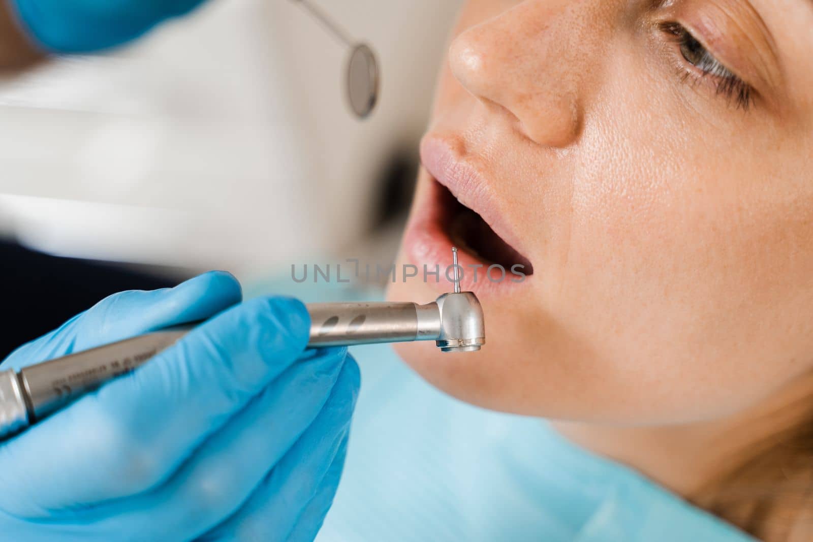Dental drill close-up. Dentist drilling teeth of woman in dentistry clinic. Teeth treatment. Dental filling for girl patient. by Rabizo