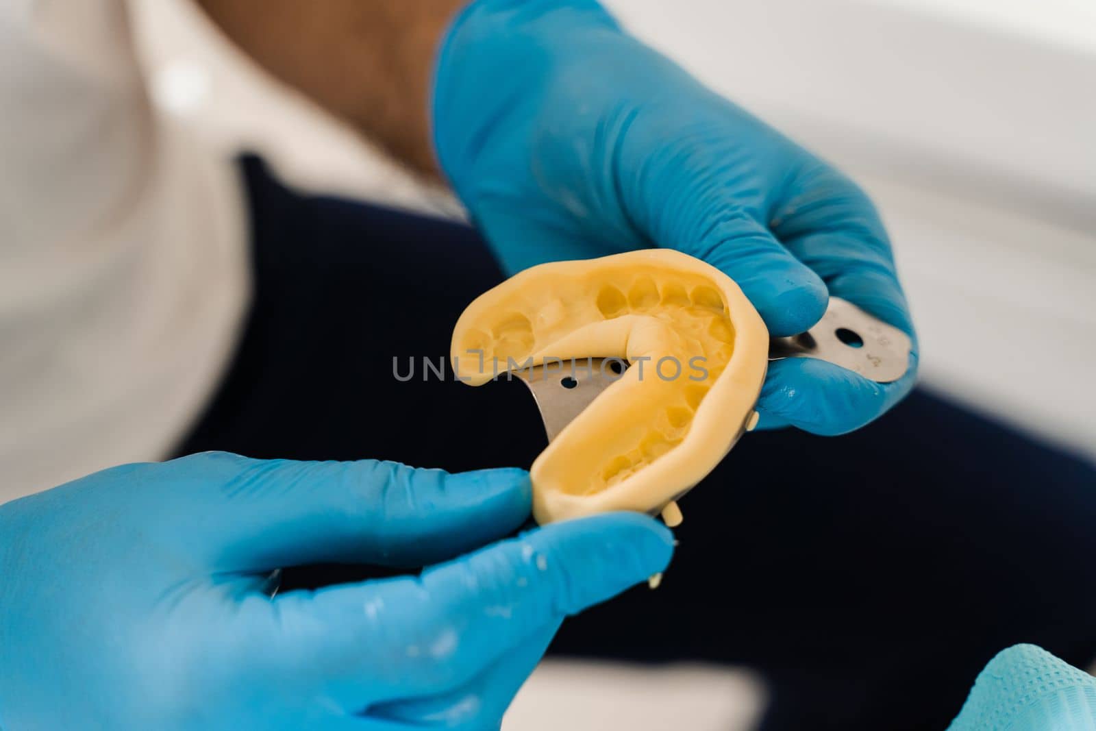 Dental cast of teeth of jaw close-up. Visiting dentist before dental implantation. Procedure of creating dental prostheses, crowns and aligners