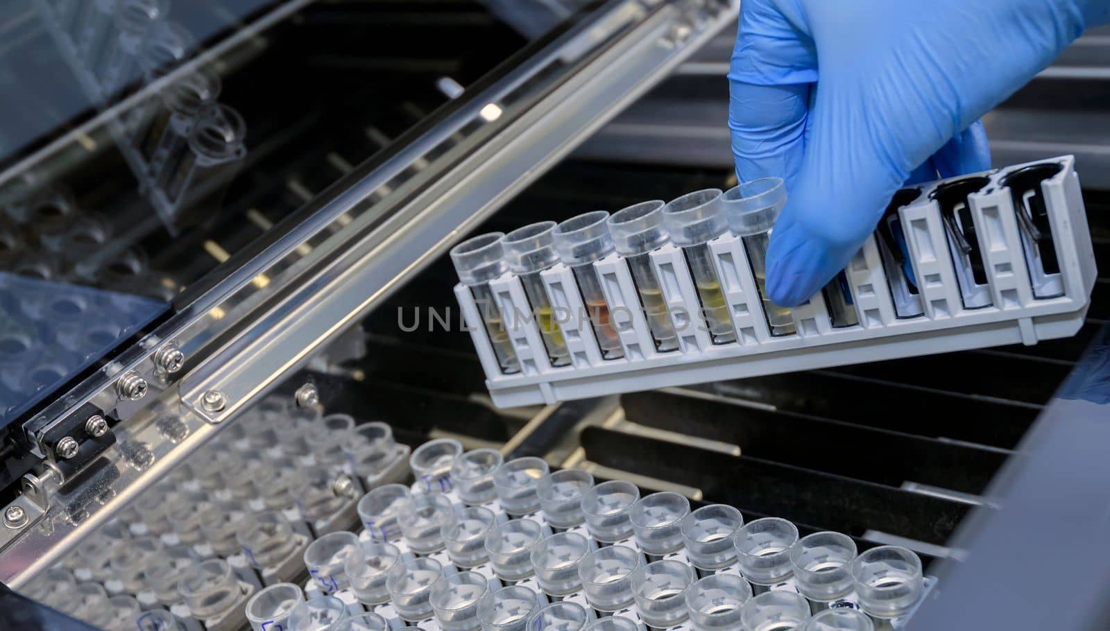 laboratory assistant is analyzing fluid, gloved hand