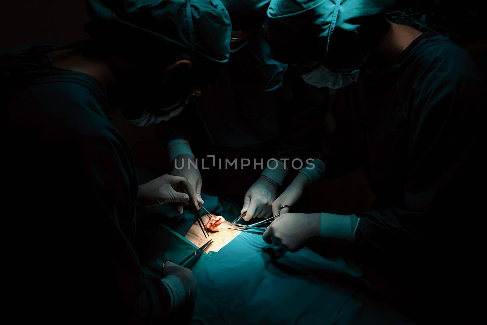 Surgical team performing surgery to patient in sterile operating room. In a surgery room lit by a lamp, a professional and confident surgical team provides medical care to an unconscious patient.