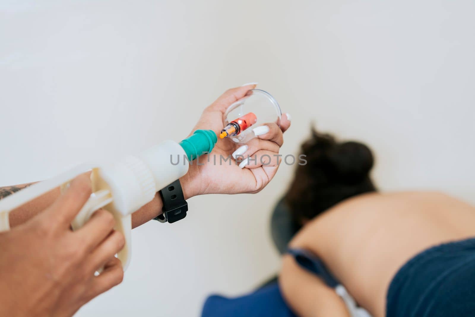 Close up of professional performing cupping treatment on patient, Modern Physiotherapy with cupping cups, Physiotherapist placing cupping on lying patient