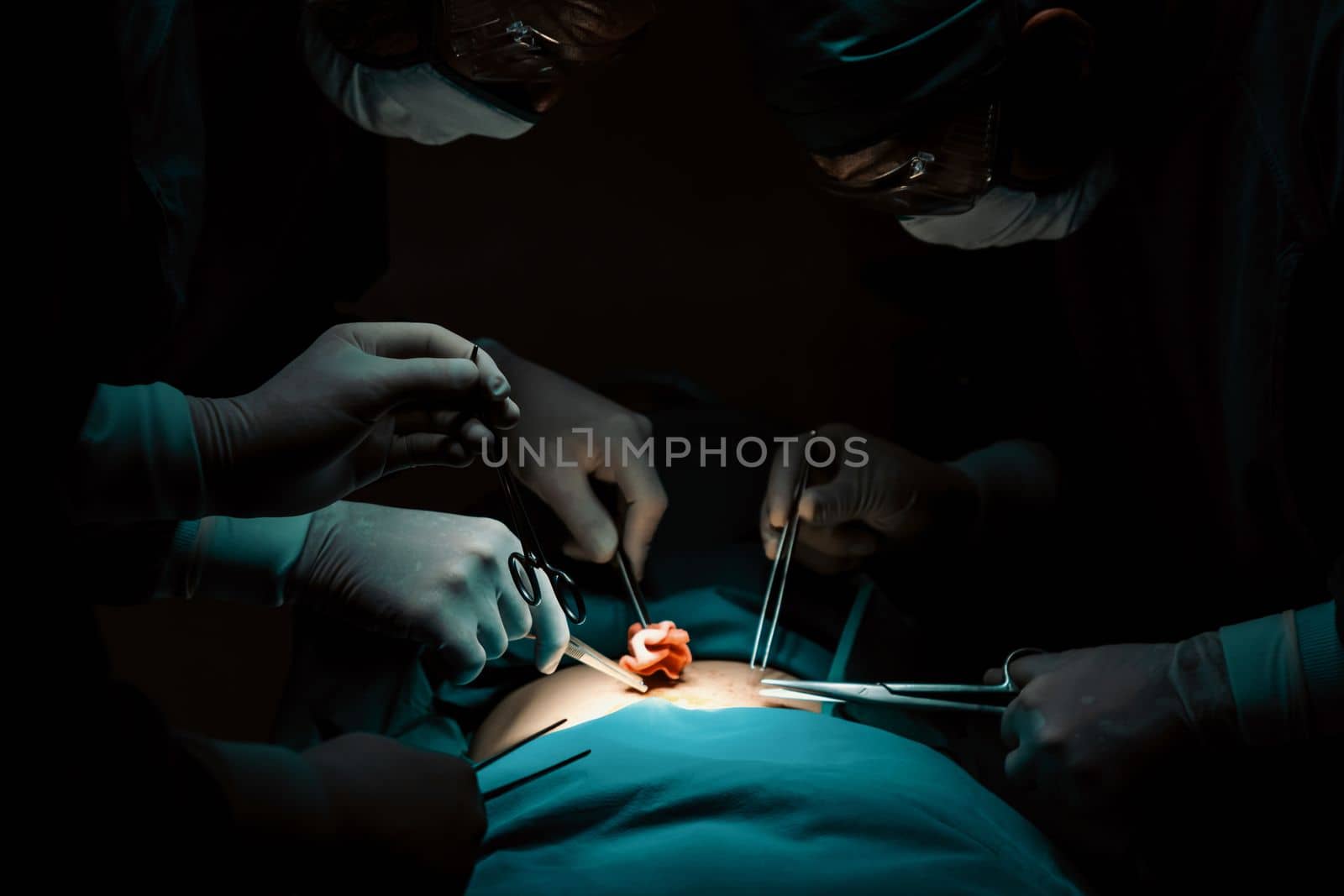 Surgical team performing surgery to patient in sterile operating room. In a surgery room lit by a lamp, a professional and confident surgical team provides medical care to an unconscious patient.