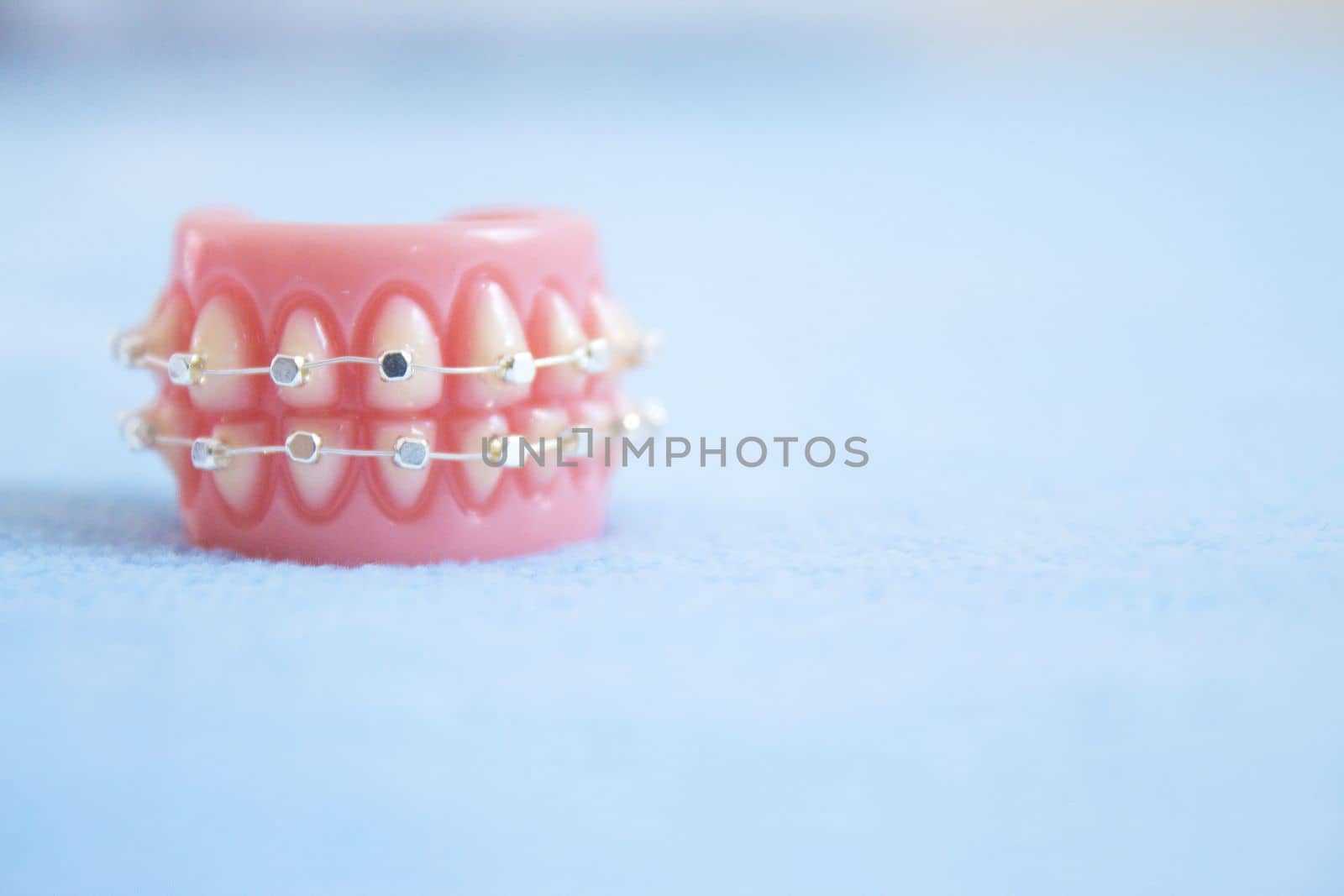 Metal orthodontic denture base. No people